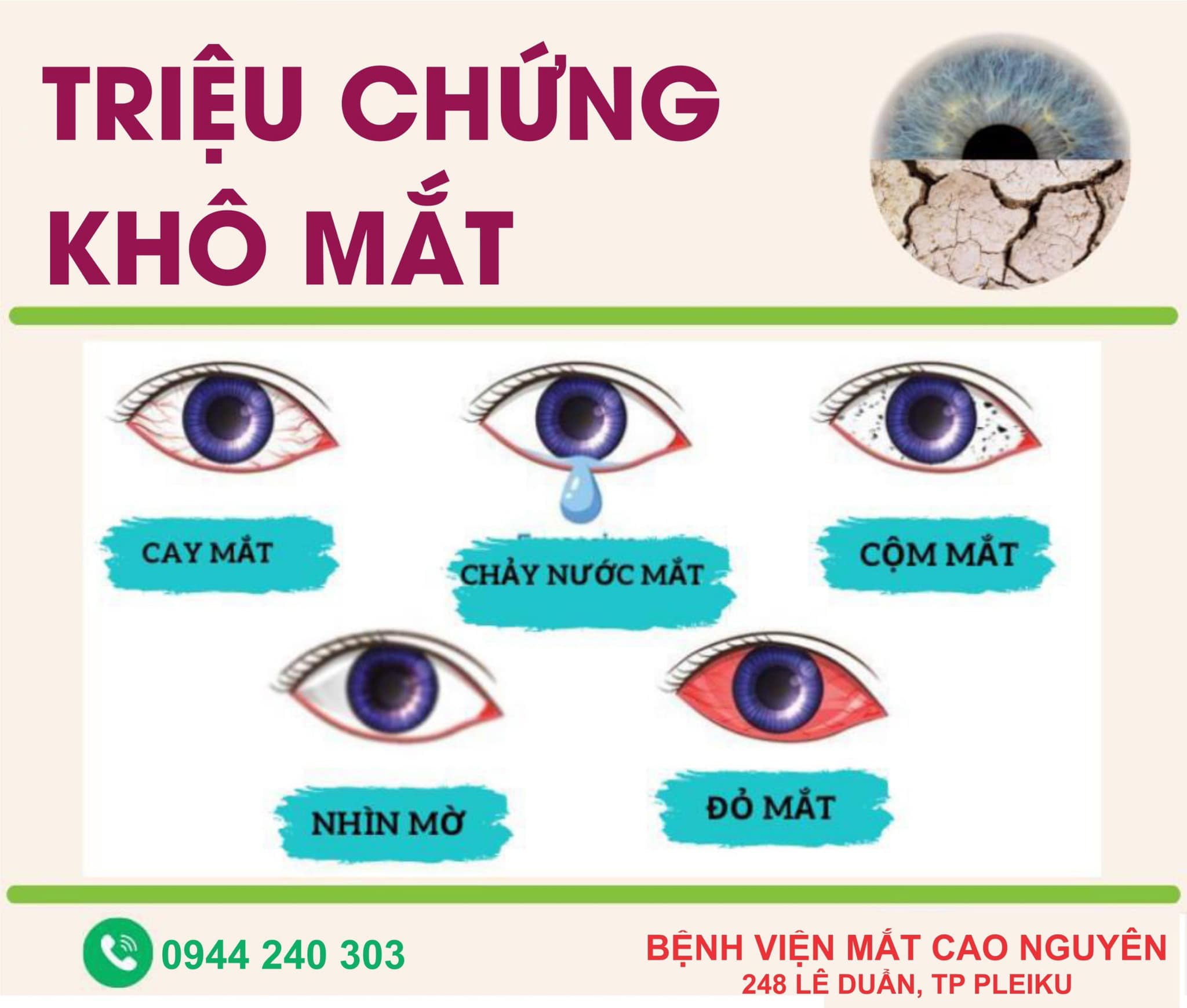 Triệu chứng khô mắt