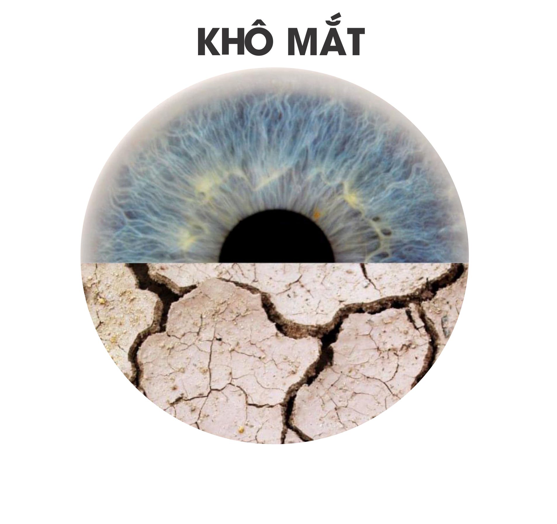 Khô mắt