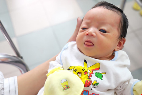 Triệu chứng Glôcôm bẩm sinh ở trẻ