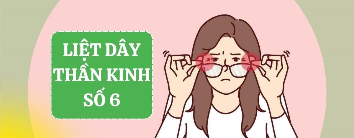 Liệt dây thần kinh số VI