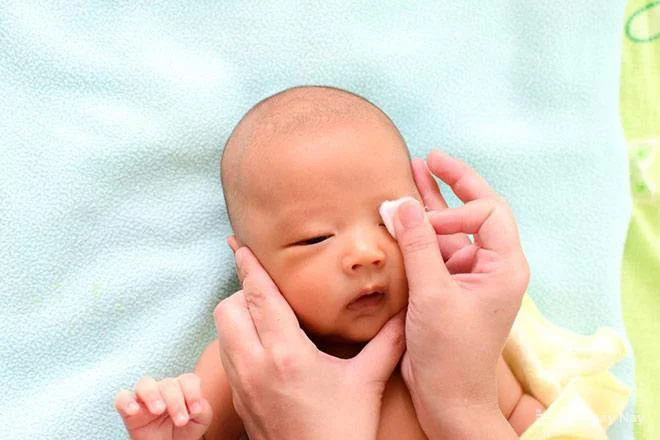 Sụp mi bẩm sinh có thể làm suy giảm thị lực