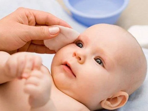 Tắc lệ đạo bẩm sinh ở trẻ em